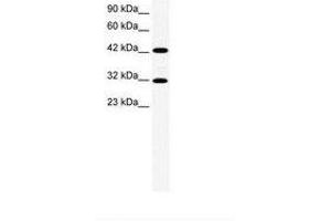 Image no. 1 for anti-General Transcription Factor IIH, Polypeptide 2, 44kDa (GTF2H2) (AA 299-348) antibody (ABIN202422) (GTF2H2 Antikörper  (AA 299-348))