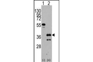 Western blot analysis of ZIC4 (arrow) using rabbit polyclonal ZIC4 Antibody (C-term) (ABIN389183 and ABIN2839346). (ZIC4 Antikörper  (C-Term))