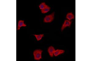 ABIN6265998 and ABIN6273087 staining HepG2 by IF/ICC. (VPS37A Antikörper  (N-Term))