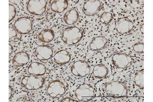 Image no. 4 for anti-Glutaminyl-tRNA Synthetase (QARS) (AA 677-776) antibody (ABIN598566) (QARS Antikörper  (AA 677-776))