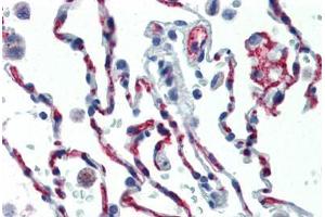 Human Lung (formalin-fixed, paraffin-embedded) stained with CD34 antibody ABIN461990 at 1:50 followed by biotinylated anti-mouse IgG secondary antibody ABIN481714, alkaline phosphatase-streptavidin and chromogen. (CD34 Antikörper  (FITC))