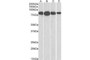 ABIN2564861 (0. (Radixin Antikörper  (Internal Region))