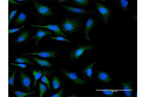 Immunofluorescence of purified MaxPab antibody to C19orf10 on HeLa cell.