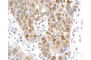 Immunohistochemistry (IHC) image for anti-Glyceraldehyde-3-Phosphate Dehydrogenase (GAPDH) (AA 225-275) antibody (ABIN7449428)