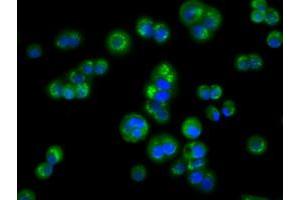 Image no. 5 for anti-Acetyl-CoA Acetyltransferase 2 (ACAT2) antibody (ABIN1496401) (ACAT2 Antikörper)