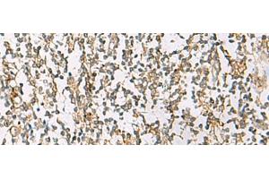 Immunohistochemistry of paraffin-embedded Human tonsil tissue using ZPBP2 Polyclonal Antibody at dilution of 1:80(x200) (ZPBP2 Antikörper)