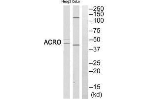 Western Blotting (WB) image for anti-Acrosin (ACR) (Cleaved-Ile43), (N-Term) antibody (ABIN1853476) (Acrosin Antikörper  (Cleaved-Ile43, N-Term))