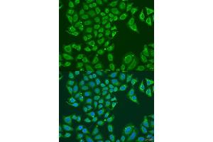 Immunofluorescence analysis of U2OS cells using B1 antibody (ABIN7265534) at dilution of 1:100. (ALDH1B1 Antikörper  (AA 278-517))