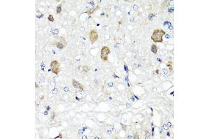 Immunohistochemistry of paraffin-embedded rat brain using RBP2 antibody (ABIN5974059) at dilution of 1/100 (40x lens). (RBP2 Antikörper)
