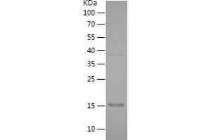 Western Blotting (WB) image for Septin 7 (SEPT7) (AA 76-227) protein (His tag) (ABIN7282665) (Septin 7 Protein (SEPT7) (AA 76-227) (His tag))