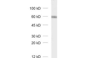 dilution: 1 : 1000, sample: unboiled synaptic membrane fraction of rat brain (LP1) (GABRA3 Antikörper  (AA 29-43))