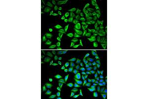Immunofluorescence analysis of HeLa cells using CRP antibody.