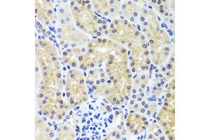 Immunohistochemistry of paraffin-embedded mouse kidney using INADL antibody at dilution of 1:100 (x40 lens). (PATJ Antikörper)