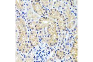 Immunohistochemistry of paraffin-embedded mouse kidney using INADL antibody at dilution of 1:100 (x40 lens). (PATJ Antikörper)