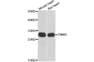 Western blot analysis of extracts of various cell lines, using TNNI3 antibody. (TNNI3 Antikörper)
