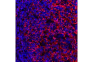 Immunofluorescence (IF) image for anti-Membrane-Spanning 4-Domains, Subfamily A, Member 1 (MS4A1) antibody (ABIN7449560) (CD20 Antikörper)