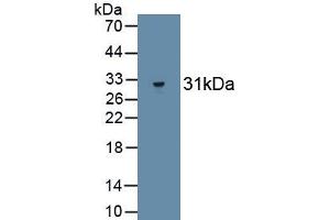Detection of Recombinant SELP, Human using Monoclonal Antibody to P-Selectin (SELP)