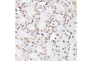 Immunohistochemistry of paraffin-embedded rat kidney using Phospho-c-Abl-Y412 antibody (ABIN7265966) at dilution of 1:100 (40x lens).