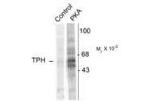 Image no. 1 for anti-Tryptophan Hydroxylase 1 (TPH1) (pSer58) antibody (ABIN227714) (Tryptophan Hydroxylase 1 Antikörper  (pSer58))
