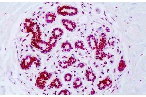 Image no. 3 for anti-Histone H3 (H3) (H3K18ac) antibody (ABIN2879163) (Histone 3 Antikörper  (H3K18ac))