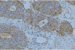 ABIN6276676 at 1/100 staining Human uterus tissue by IHC-P. (LIPC Antikörper  (Internal Region))