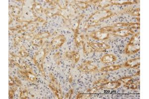 Immunostaining (ISt) image for anti-Formin Homology 2 Domain Containing 1 (FHOD1) (AA 1-1164) antibody (ABIN526087)