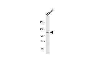 Anti-OTUD7A Antibody (N-term) at 1:1000 dilution + Mouse brain lysate Lysates/proteins at 20 μg per lane. (OTUD7A Antikörper  (N-Term))