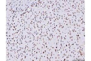 IHC analysis of TPR using anti-TPR antibody (ABIN7603243). (TPR Antikörper  (N-Term))