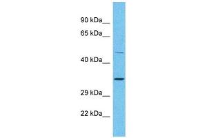 Host: Rabbit Target Name: OR2A25 Sample Type: Placenta lysates Antibody Dilution: 1.