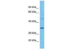 Host: Rabbit Target Name: OR2A25 Sample Type: Placenta lysates Antibody Dilution: 1. (OR2A25 Antikörper  (C-Term))