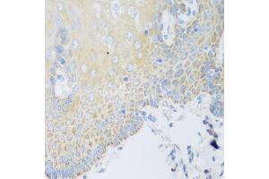 Immunohistochemistry of paraffin-embedded human esophagus using DHODH antibody. (DHODH Antikörper  (AA 116-395))