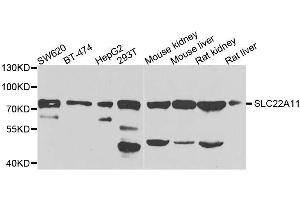 Western blot analysis of extracts of various cell lines, using SLC22A11 antibody. (SLC22A11 Antikörper  (AA 40-150))