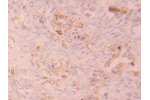 Detection of FGFR1 in Human Ovary Tissue using Polyclonal Antibody to Fibroblast Growth Factor Receptor 1 (FGFR1) (FGFR1 Antikörper  (AA 236-362))