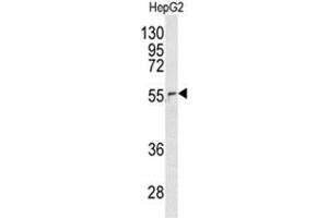 Western blot analysis of NUP62 antibody (C-term E507) in HepG2 cell line lysates (35ug/lane). (NUP62 Antikörper  (C-Term))