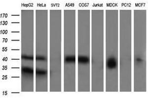 Image no. 4 for anti-Parvin, alpha (PARVA) antibody (ABIN1496446) (Parvin alpha Antikörper)