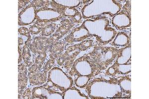 IHC analysis of Annexin A10/ANXA10 using anti-Annexin A10/ANXA10 antibody (ABIN7601853). (Annexin a10 Antikörper  (AA 49-324))