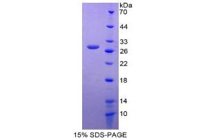 SDS-PAGE (SDS) image for Inhibin Binding Protein (INHBP) (AA 1008-1227) protein (His tag) (ABIN2125253)