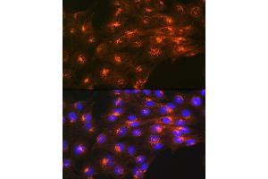 Immunofluorescence analysis of C6 cells using Cation-independent Cation-independent M6PR (IGF2R) (IGF2R) Rabbit mAb (ABIN1678848, ABIN3018066, ABIN3018067 and ABIN7101574) at dilution of 1:100 (40x lens). (IGF2R Antikörper)