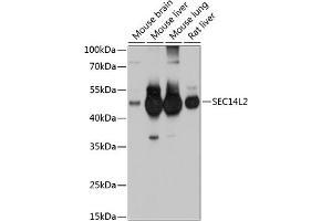Western blot analysis of extracts of various cell lines, using SEC14L2 antibody (ABIN6132639, ABIN6147484, ABIN6147485 and ABIN6214889) at 1:1000 dilution. (SEC14L2 Antikörper  (AA 60-270))