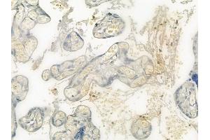 ABIN6265334 and ABIN6276392 at 1/100 staining human normal placenta tissue by IHC-P. (STEAP3 Antikörper  (N-Term))