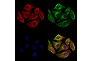 ABIN6260842 and ABIN6273209 staining Hela cells by IF/ICC. (SH3KBP1 Antikörper  (N-Term))
