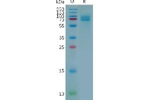 Human CD166 Protein, His Tag on SDS-PAGE under reducing condition.