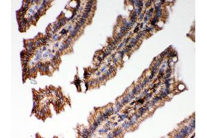 Immunohistochemistry (IHC) image for anti-Major Histocompatibility Complex Class I C (HLA-C) (AA 38-62), (C-Term) antibody (ABIN3043843)