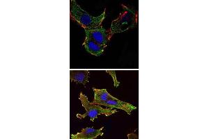 Immunofluorescence analysis of NTERA-2 cells (upper) and U251 (bottom) cells using KLHL13 monoclonal antibody, clone 8D1  (green) . (KLHL13 Antikörper)