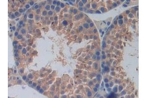 Detection of IL17RA in Mouse Testis Tissue using Polyclonal Antibody to Interleukin 17 Receptor A (IL17RA)