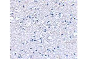 Immunohistochemical staining of human brain tissue using GRIK4 polyclonal antibody  at 2.