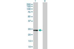 Western Blot analysis of SNAP23 expression in transfected 293T cell line by SNAP23 MaxPab polyclonal antibody. (SNAP23 Antikörper  (AA 1-211))