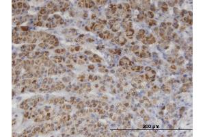 Immunostaining (ISt) image for anti-Phosphoinositide-3-Kinase, Class 2, alpha Polypeptide (PIK3C2A) (AA 1577-1686) antibody (ABIN518885)