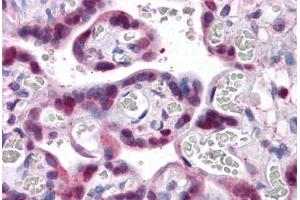 Human Placenta: Formalin-Fixed, Paraffin-Embedded (FFPE) (SMAD6 Antikörper  (AA 285-385))
