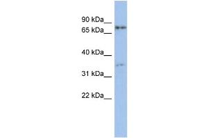 WB Suggested Anti-EOMES Antibody Titration:  0. (EOMES Antikörper  (Middle Region))